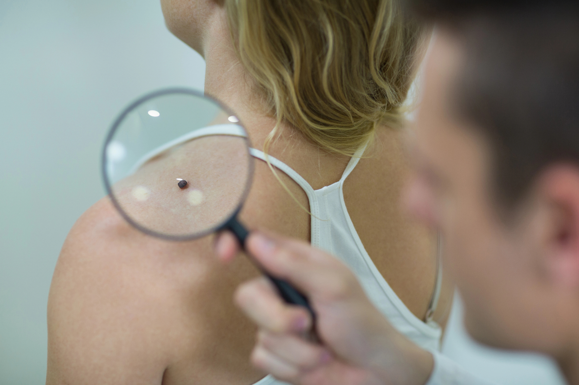 Zdravnik dermatolog vedno bolj iskan poklic